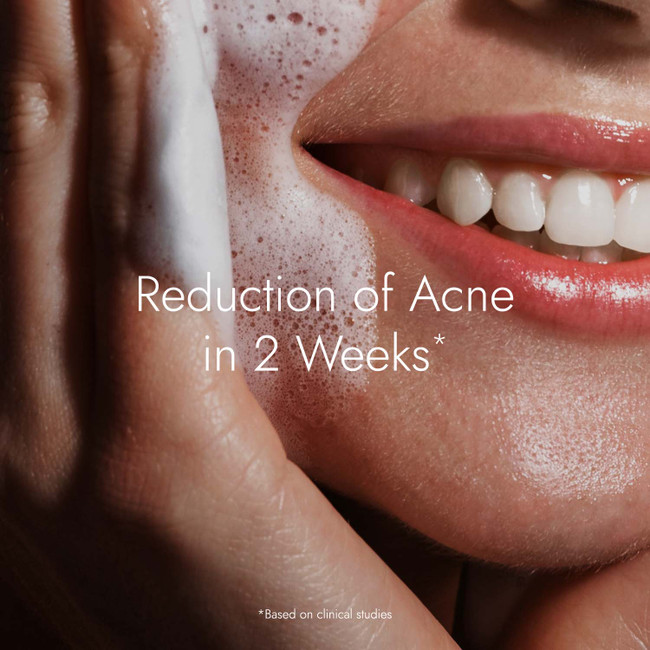 Picture of Kapiva Ayurveda Acne Regime - Acne Face Wash & Tulsi Anti Acne Serum & Aloe Rose Gel